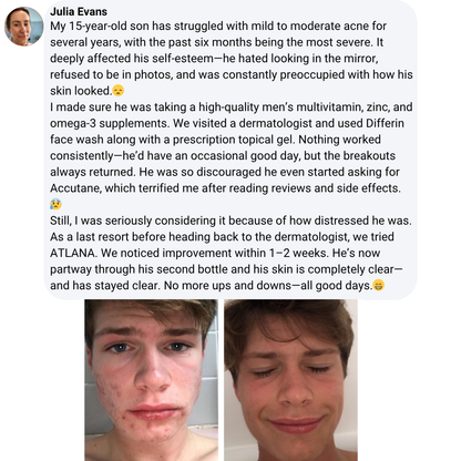 Alatna MINDBODYSKIN®