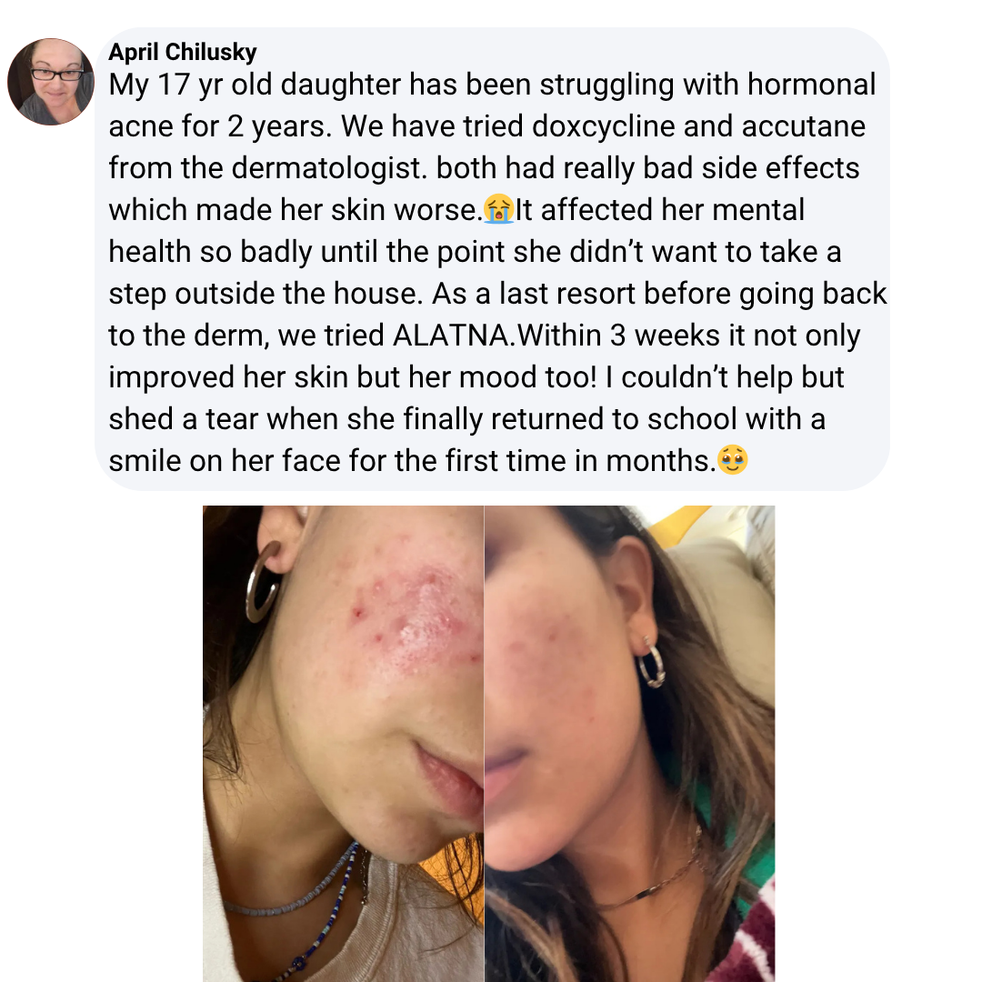 Alatna MINDBODYSKIN®